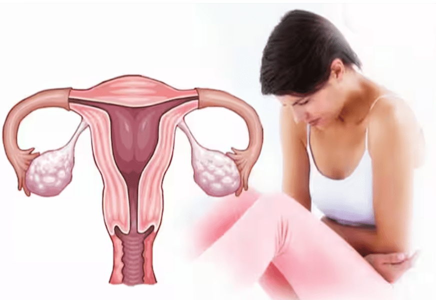 Cervical Cancer in Women: Early Signs, Causes & Prevention for a Healthier Future
